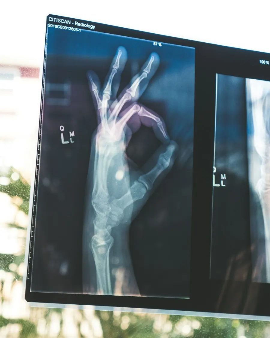 Orthopedic surgeon reviewing a knee X-ray with a patient, orthopedic billing services